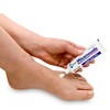 Miconazole Globe (3 Pack) Nitrate 2% Cream 1 oz, Cures