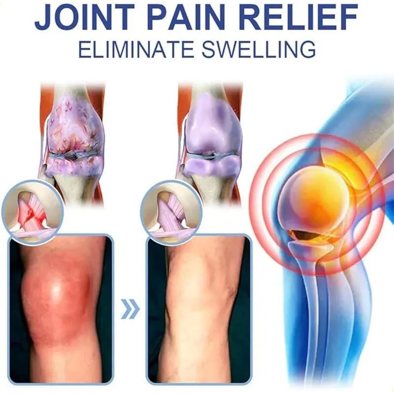 Crema Para Aliviar El Dolor De Magnesio Timilk Enduraheal, A