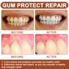 Pack of 2 Gum Gel, Gum Recovery Drops, Gum Repair
