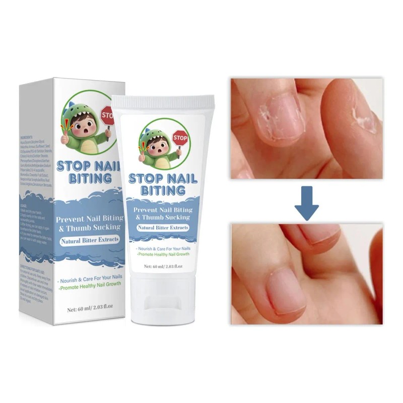 Crema Para El Cuidado De Uñas: Morder Las Uñas, Comer