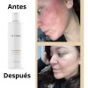 Tónico Facial Caléndula Farmasi Dr C Tuna Piel Seca Sensible