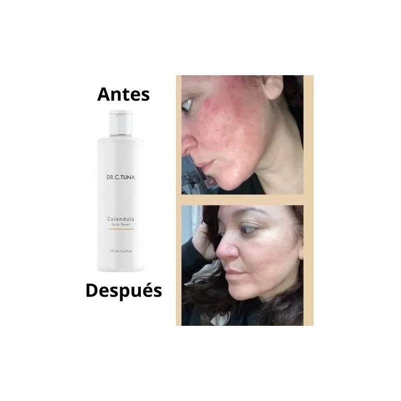 Tónico Facial Caléndula Farmasi Dr C Tuna Piel Seca Sensible