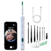 Ear Wax Removal, Ear Cleaner with Camera and Light, Ear