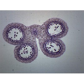 EISCO 10PK Lilium Anther, 1st Meiotic Division - Prepared Microscope Slides - Classroom Pack, 10 Slides in Storage Case - Biology & Microscopy