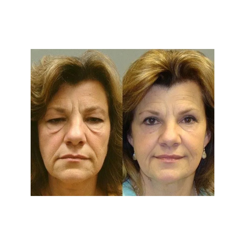 Skindulgence Mascarilla Rejuvenece En 30 Minutos