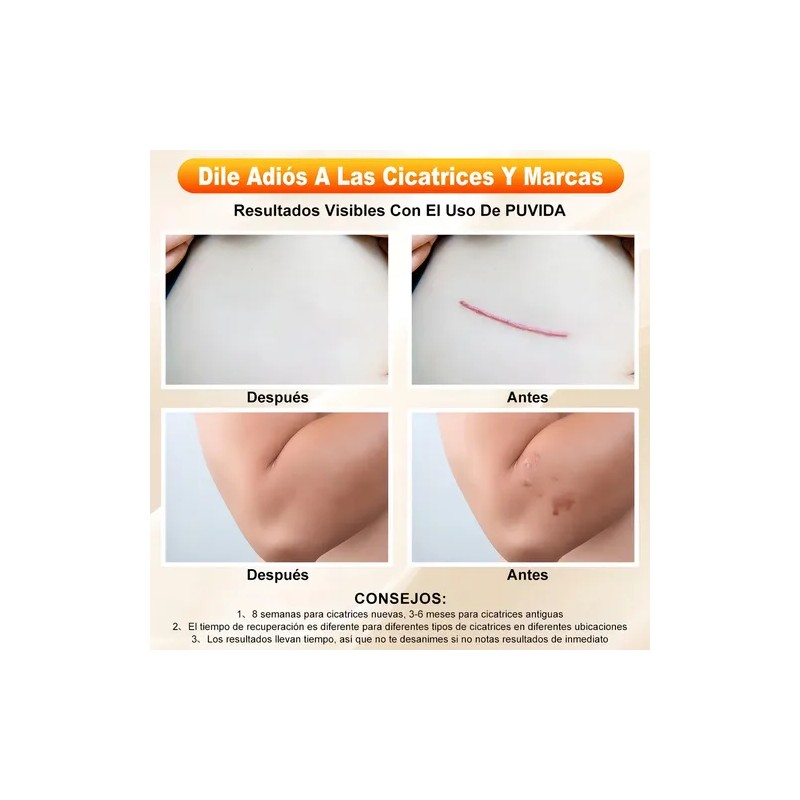 Gel Puvida Cicatrizante para Rostro y Cuerpo, de Día y