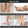 Segbeauty Heel Open Toe Socks, 4 Pairs Gel Heel Socks,