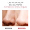 Limpiador Facial Ultrasónico Skin Scrubber con Espátula Kit Limpieza