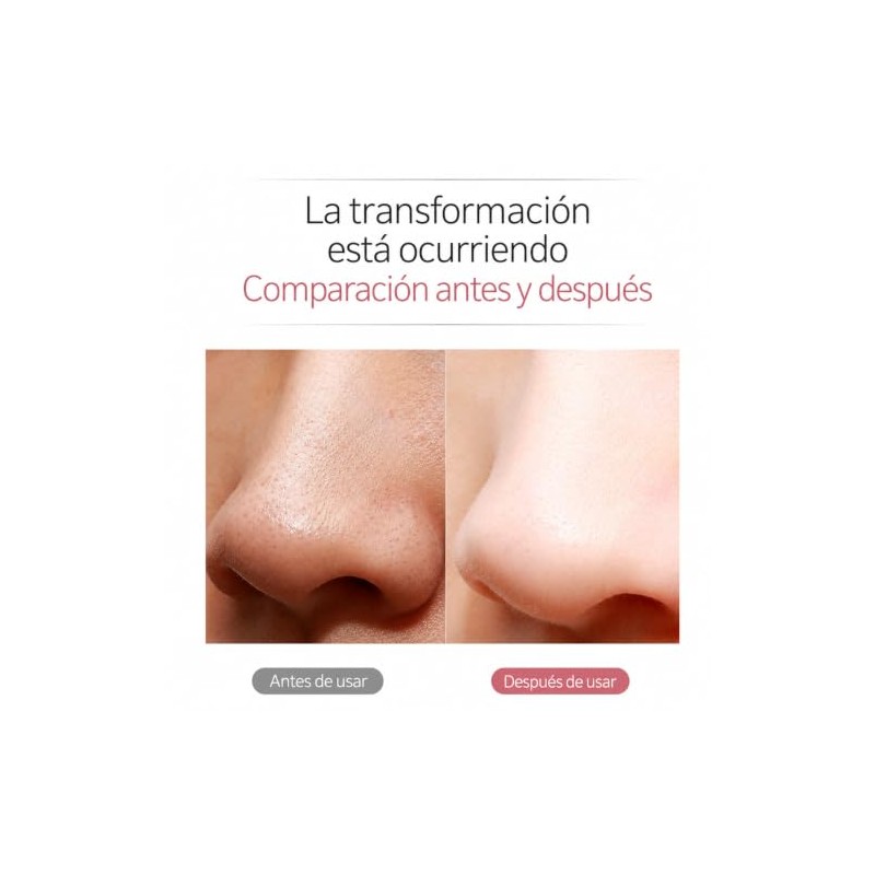 Limpiador Facial Ultrasónico Skin Scrubber con Espátula Kit Limpieza