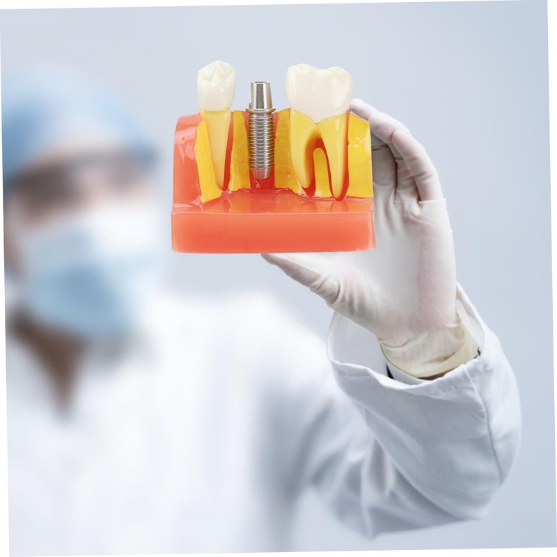 Gatuida 1pc Tooth Model Learher Gronwn Ups Teeth Teaching Model