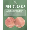 Kit Ácido Hialurónico+cremahumectante+serum Piel Grasa 7pza