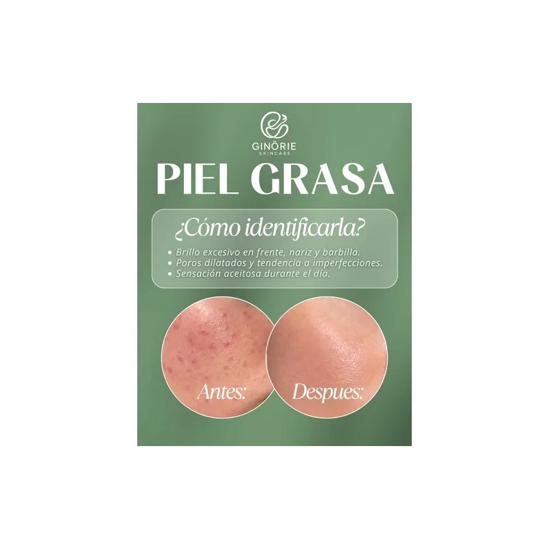 Kit Ácido Hialurónico+cremahumectante+serum Piel Grasa 7pza