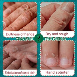 Hand Cream Gift Set - 5PCS Hand Cream for Very Dry Hands - Deep Hydrating&Nourishing Non-greasy Hand Cream - Vegan Friendly and Cruelty Free Plant Scent Gifts for Her on Christmas