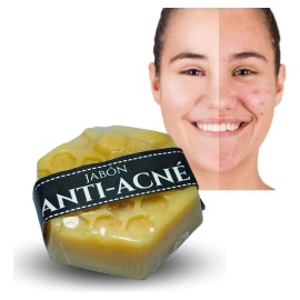 Jabón Anti Acné Para Barros Y Espinillas Natural Y Efectivo