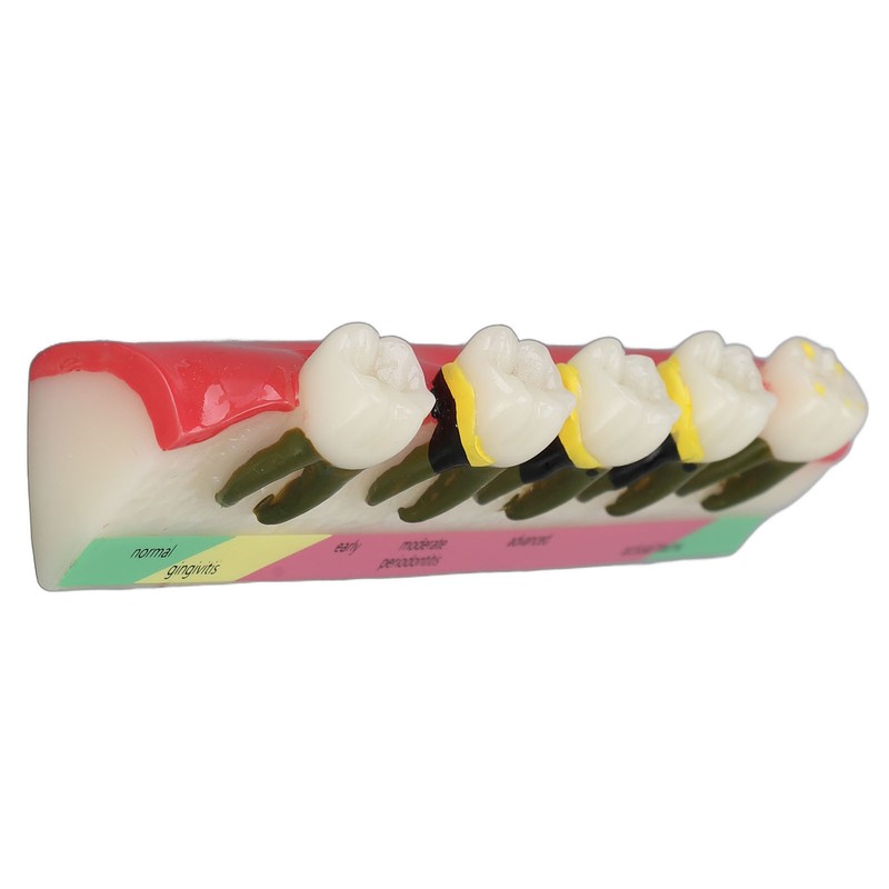 Dental Teeth Model Ceramic Clear Structure Oral Care Educational Periodontal