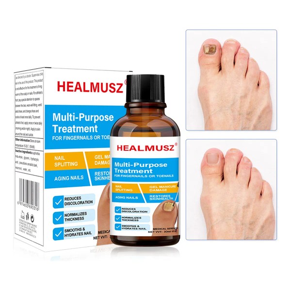 Uñas Hongo Liquido-solución Reparadora Para Uñas 30ml