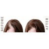 4X Advanced Anti Hair Loss Treatment DHT Blocker Fast Growth