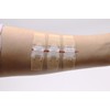 Laceration Wound Closure Device, Emergency Laceration Closure Strips to Repair