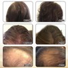 Joyce Giraud Ultimate Hair Strength Supplements 30-Day Supply, Scientifically Formulated