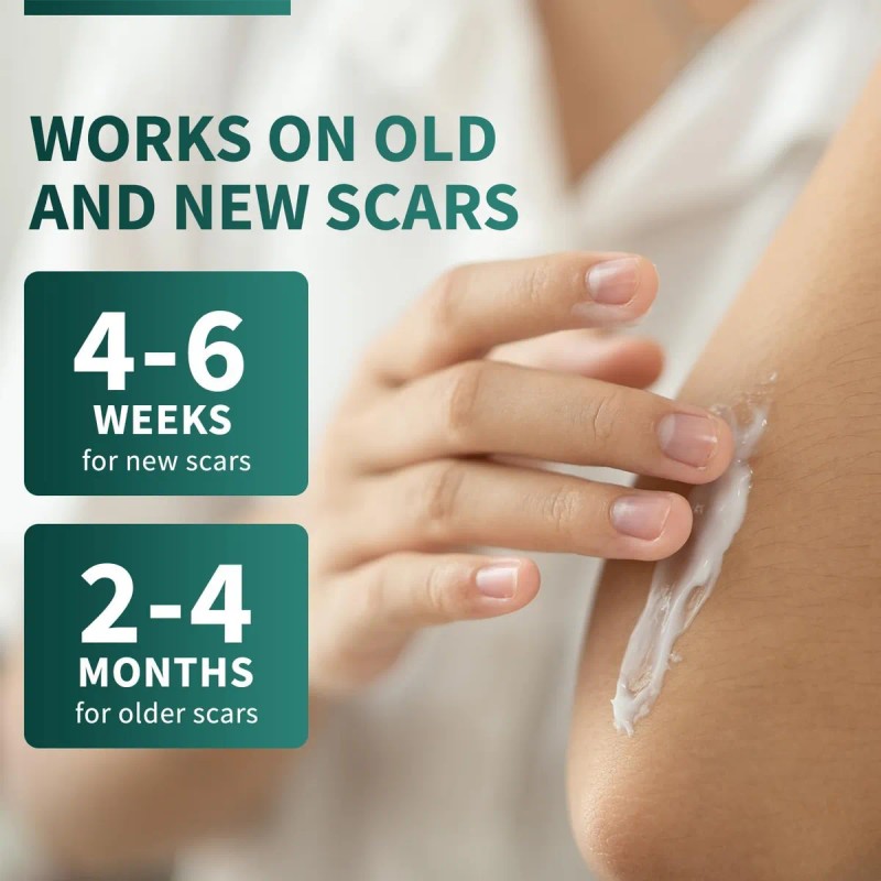 Crema De Silicona Protect Life Para Cicatrices Quirúrgicas,