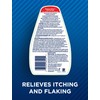 Selsun Blue - Itchy Dry Scalp Formula- 300 ML -