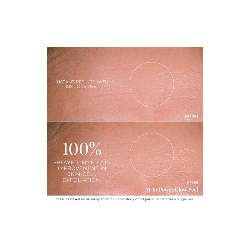 M-61 PowerGlow Peel, Size 30 Treatments