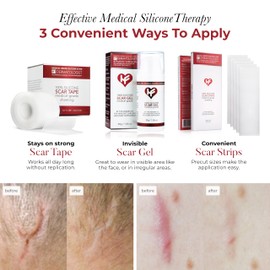 HealFast Physician Formulated Silicone Scar Sheets - Advanced Crosspolymer Medical Grade Silicone Scar Tape for Surgery, C Section, Keloids & Hypertrophic Scars - Silicone Tape For Scars