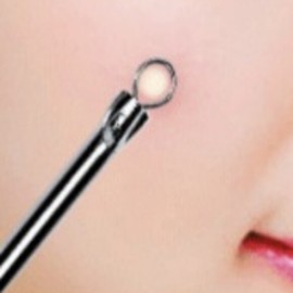 Ring-type extractor for bumpy skin, uneven butterfly zone, boil extraction, and ear blackheads / 링타입압출기 피부오돌토돌 나비존요철 종기짜기 귀블랙헤드