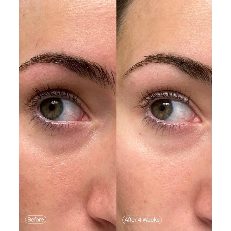 Faded Brightening Under Eye Masks – Cooling Hydrogel Eye Mask