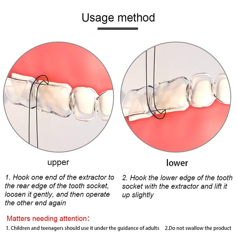 Angzhili 5 Pcs Clear Aligner Removal Tool for Invisalign Braces,Aligner