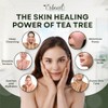 Erbaid Tea Tree Soap - Natural Acne-Fighting Cleanser