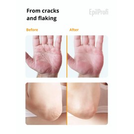 EpilProfi Vosk Crack Wax Professional Deep Moisturizer Cream for Dry Skin with Beeswax, 100ml
