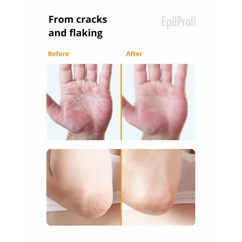 EpilProfi Vosk Crack Wax Professional Deep Moisturizer Cream for Dry