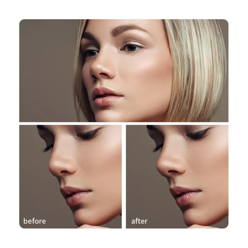 Respingador Nasal Corrector Nariz Pares Negro