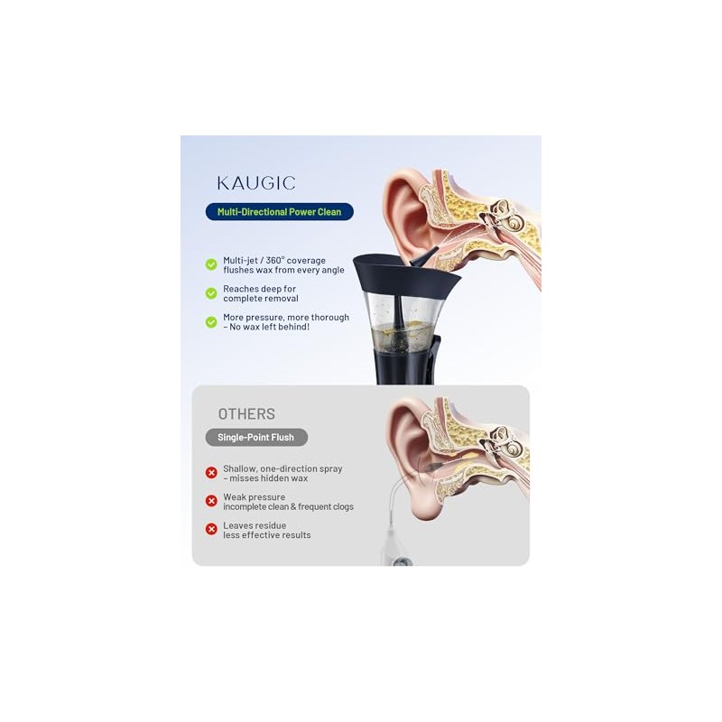 Upgraded Manual Ear Wax Removal Kit, One-Hand Control Ear Cleaner
