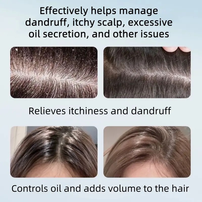 NIPPORI Selenium Disulfide Shampoo – Oil Control, Anti-Dandruff & Anti-Itch