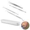도매프리 3 Types of Nail Curettes + 1 Type of Nail Clipper Nail Care Set (Total 4 Types)