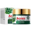 Oil Control Face Cream, Anti Acne Face Cream