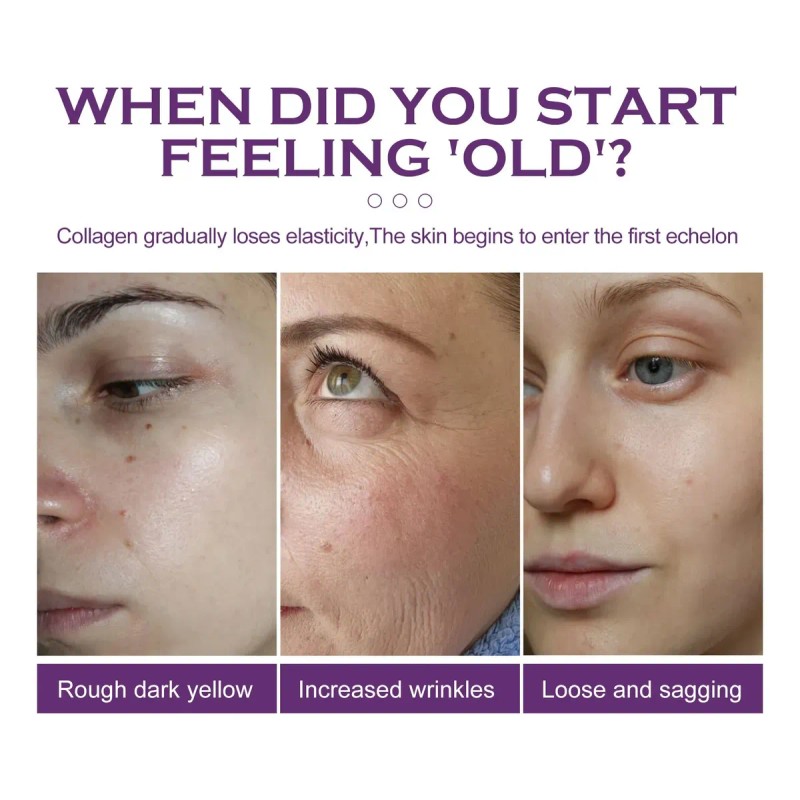 Suero De Retinol Bakuchiol, Antienvejecimiento, Reparador De