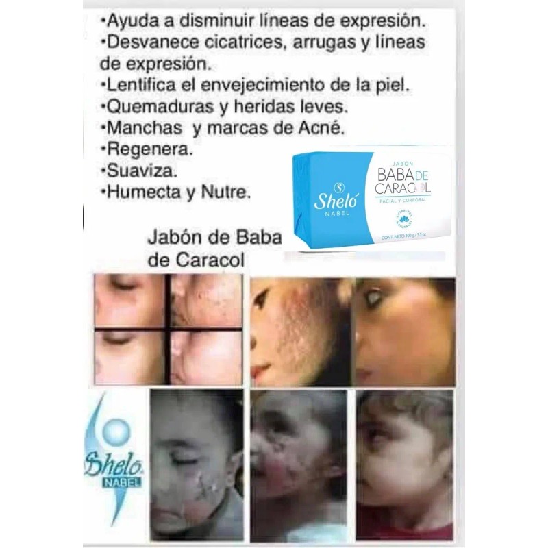 Skincare Kit Facial Cuidado Desde Interior Shelo