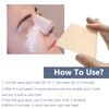 CHOYTONG Thermoplastic Nasal Splints - Nose External Support Protector for