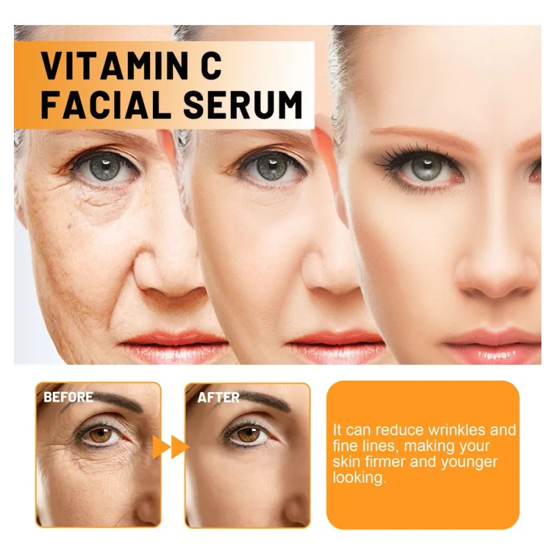 La Esencia Facial De 30 Ml Contiene Una Esencia Facial