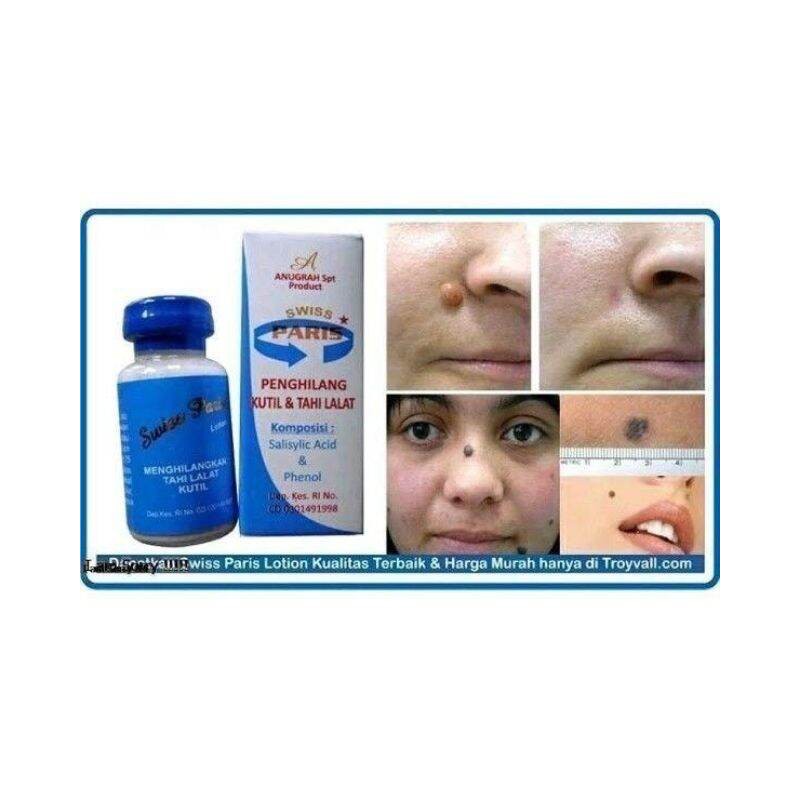 ( READY STOCK ) Swiss paris lotion penghilang kutil tahi