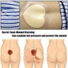 Sacral Foam Wound Dressing - Pressure Adhesive Pad for Elderly