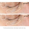 StriVectin Intensive Eye Concentrate for Wrinkles PLUS, 1 fl. oz.
