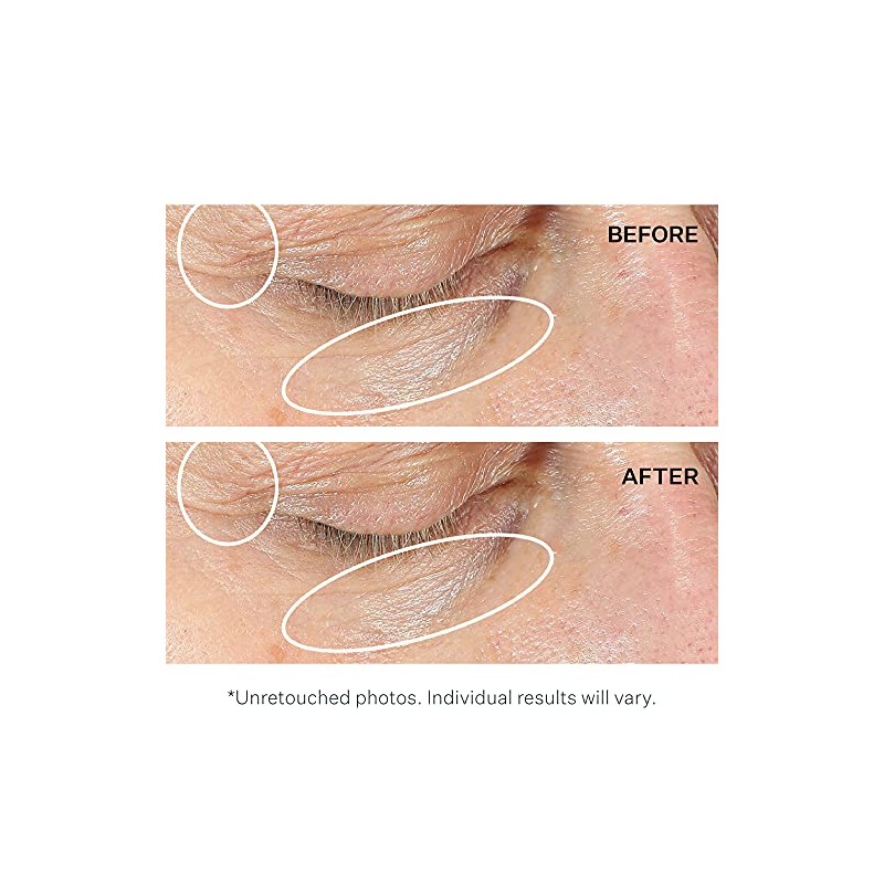 StriVectin Intensive Eye Concentrate for Wrinkles PLUS, 1 fl. oz.