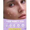 WakeALL Pimple Patches for Face, 5 Sizes(8,10,12,14,16mm)108 pcs Acne Patches