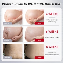 VGO VGO Body Oil with Vitamin E, After Shower Body Oil for Women, Non-Greasy & Fast-Absorbing Lightweight Moisturizer for Scars & Stretch Marks, Hydrating for Dry Sensitive Skin