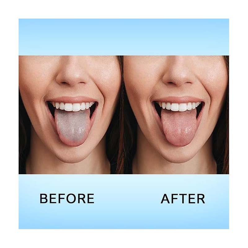 MalaMed | 2 Stück Zungenschaber, 1 x U-Form & 1