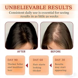 100% Raw Batana Oil Paste - Batana Oil for Hair Growth, Hair Oil for Reduces Hair Loss, Combating Dryness, Frizz And Split Ends for Dry and Frizzy Hair & All Hair Types 120ml/4 Floz